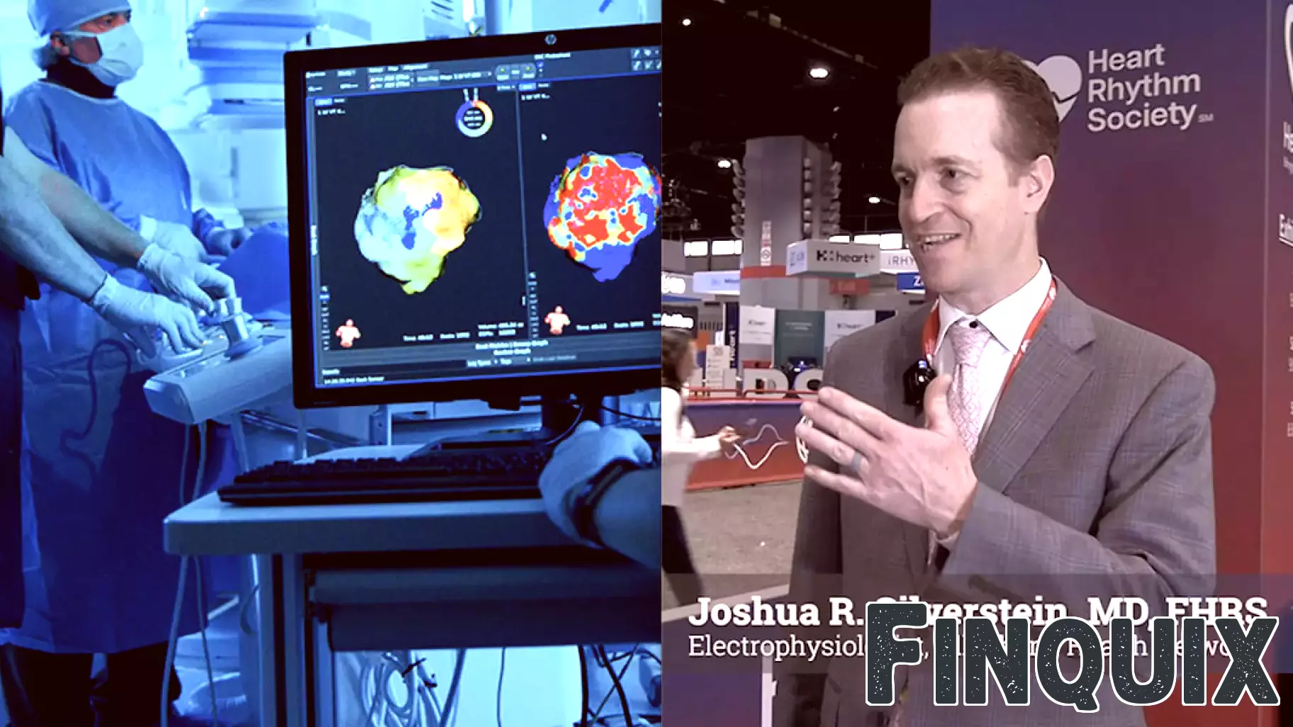 'Not sustainable': The real impact of RVU cuts in electrophysiology