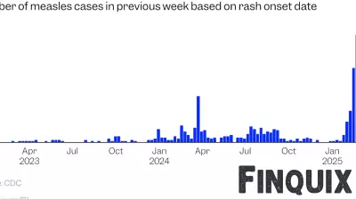 Measles Outbreak: 19 States Report Confirmed Cases, Texas Most Affected